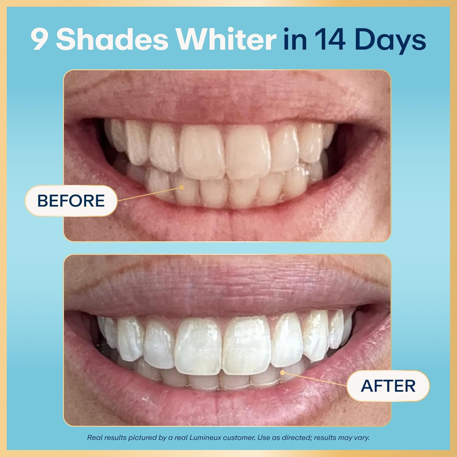 Lumineux Teeth Whitening Strips, Peroxide Free, 21 Treatments (3 Months)